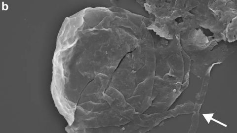 A microscopic image of the new (very old) fungus