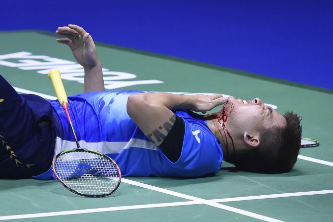 Malaysia's Teo Ee Yi lies injured after his teammate accidentally smashed him the face with his shin during a match against Japan's Takeshi Kamura and Keigo Sonoda in their men's doubles quarter-final match at the 2019 Sudirman Cup world badminton championships in Nanning, China on Friday, May 24. 