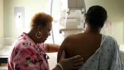 A recent study suggests widespread screening for breast cancer didn't do much to save women's lives. (Heather Charles/Chicago Tribune/TNS via Getty Images)