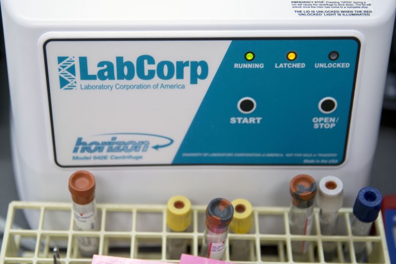 It's not just Quest LabCorp says it was hacked too CNN Business
