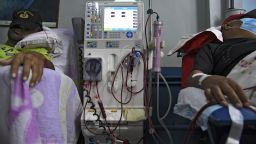 Patients suffering from renal failure receive hemodialysis treatment at a clinic in Barquisimeto, Venezuela, on April 24, 2019. - For cronic patients humanitarian aid is still far away. The fist stage of the aid is expected to last a year and will assist 650,000 people. Medicines for cronic patients are contemplated in a second stage. (Photo by YURI CORTEZ / AFP)        (Photo credit should read YURI CORTEZ/AFP/Getty Images)