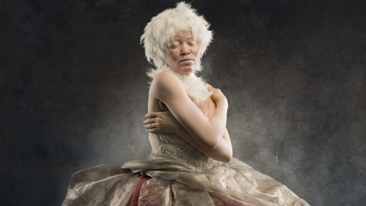 Hamzat Kabirat here is shown happy in her albinism. She feels special and has fully embraced her skin. 