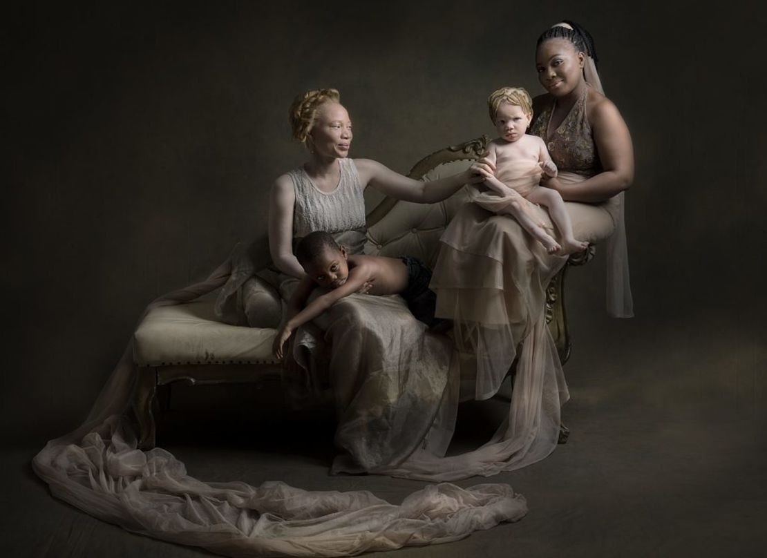 Grace Adeoshun (L) works with the Albino foundation in Lagos and has shown a lot of support for people with albinism. Here she is pictured with a dark-skinned mother, and her beautiful children in a show of support and bonding. 