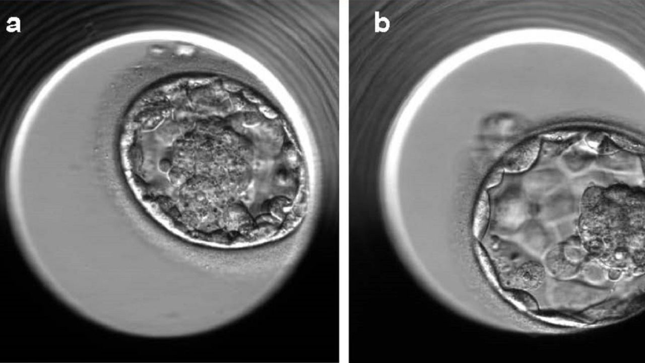 This technology could help improve the success rate of IVF