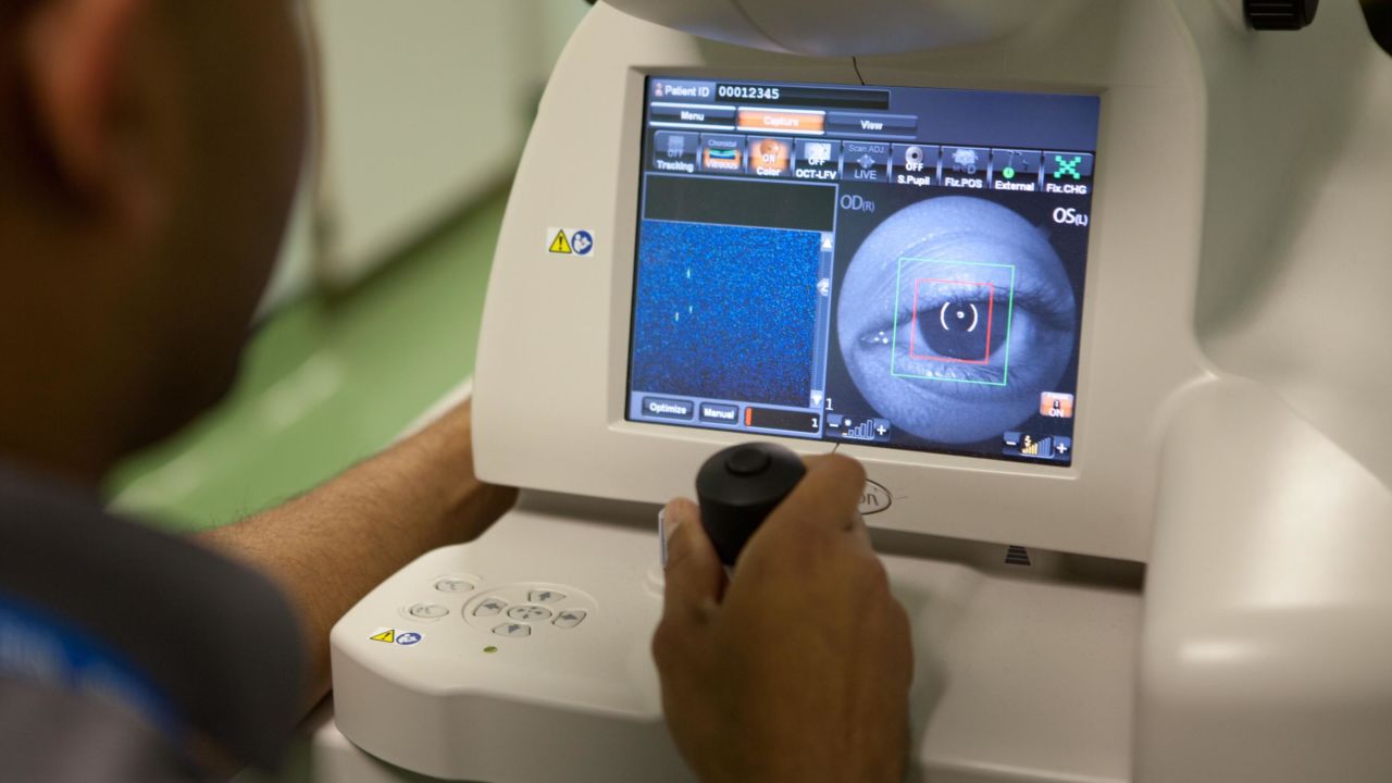 The algorithm can detect diseases such as glaucoma from a simple scan