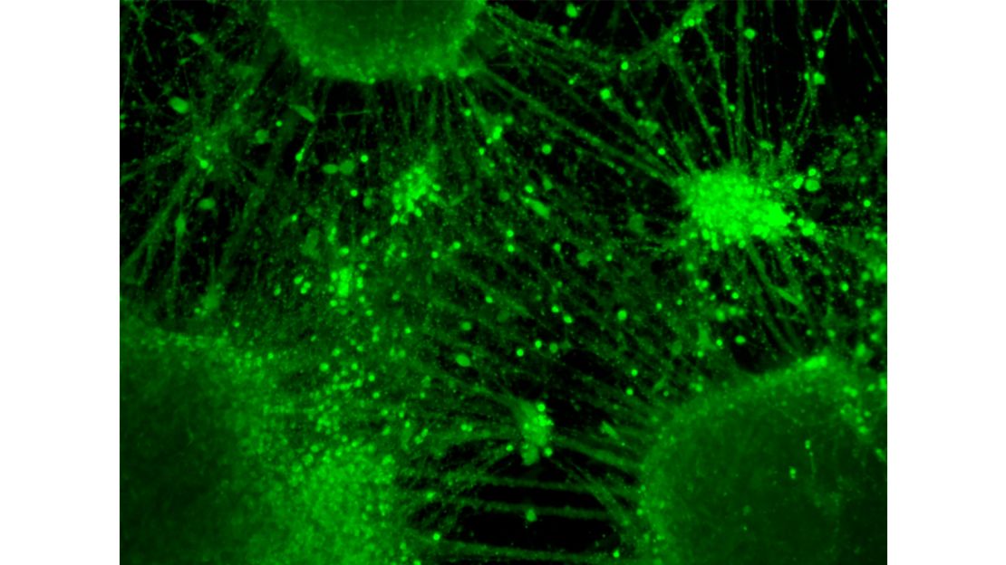 A mini-brain neural network.