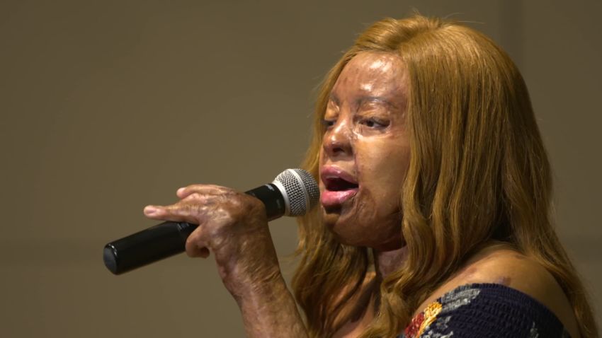 Plane crash survivor uses musical talent to show there’s ‘life after