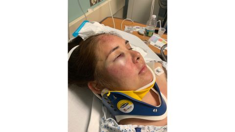 02 New jersey mom beaten