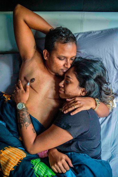 Baey said that Deveshwar Sham (left) went through a period of post-operative dysphoria after his gender reassignment surgery left huge scars on his chest. 