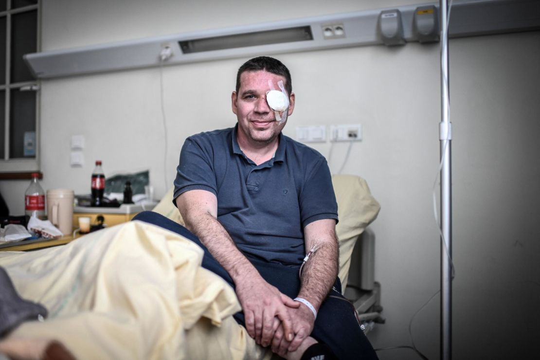 David Breidenstein says one of his great regrets is that his eye injury has kept him from protesting. He will be back on the streets on Bastille Day.