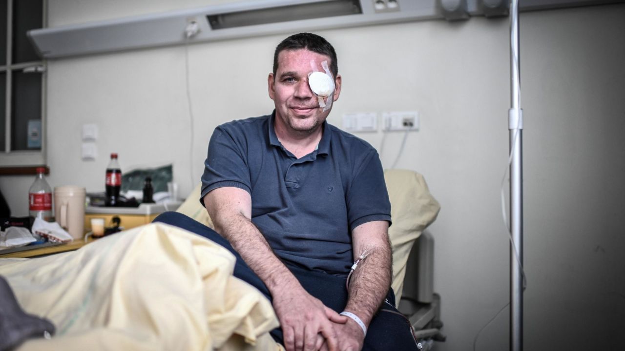 David Breidenstein says one of his great regrets is that his eye injury has kept him from protesting. He will be back on the streets on Bastille Day.