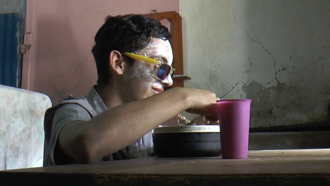 Rufo Chacon has to keep his face covered with a healing cream after being hit with dozens of crowd-control rubber pellets.