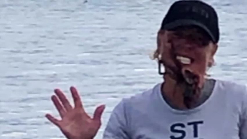 Woman Bit By Octopus Screengrab