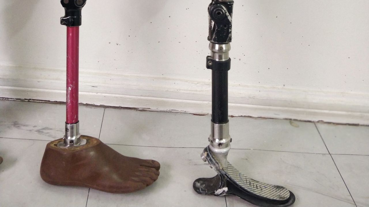 Prosthetic limbs for display at The Irede Foundation