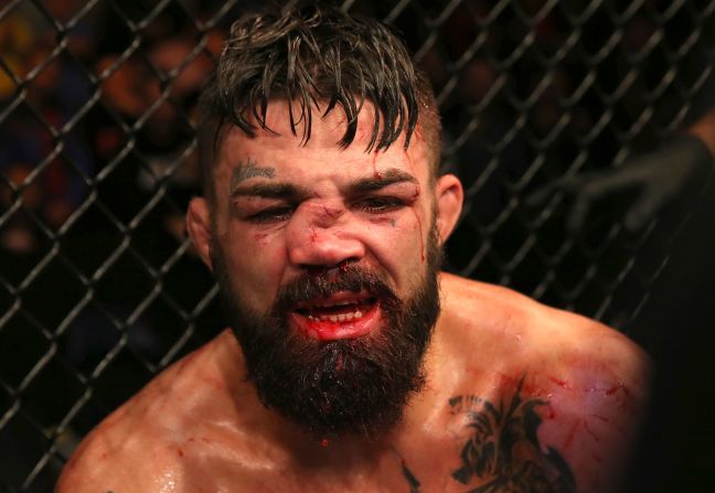 Mike Perry's nose was disfigured during his UFC fight against Vicente Luque on Saturday, August 10. Luque won the bout by split decision.