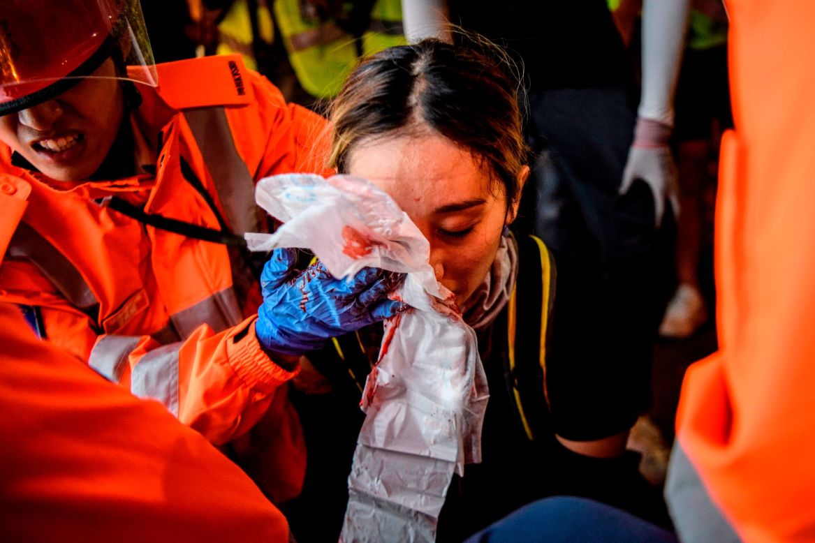 Medics look after a protester who received a facial injury during <a href="https://www.cnn.com/2019/06/09/world/gallery/hong-kong-extradition-protest/index.html" target="_blank">clashes between protesters and police</a> in Hong Kong on Sunday, August 11. Many protesters are now wearing eyepatches in reference to the woman's injury.
