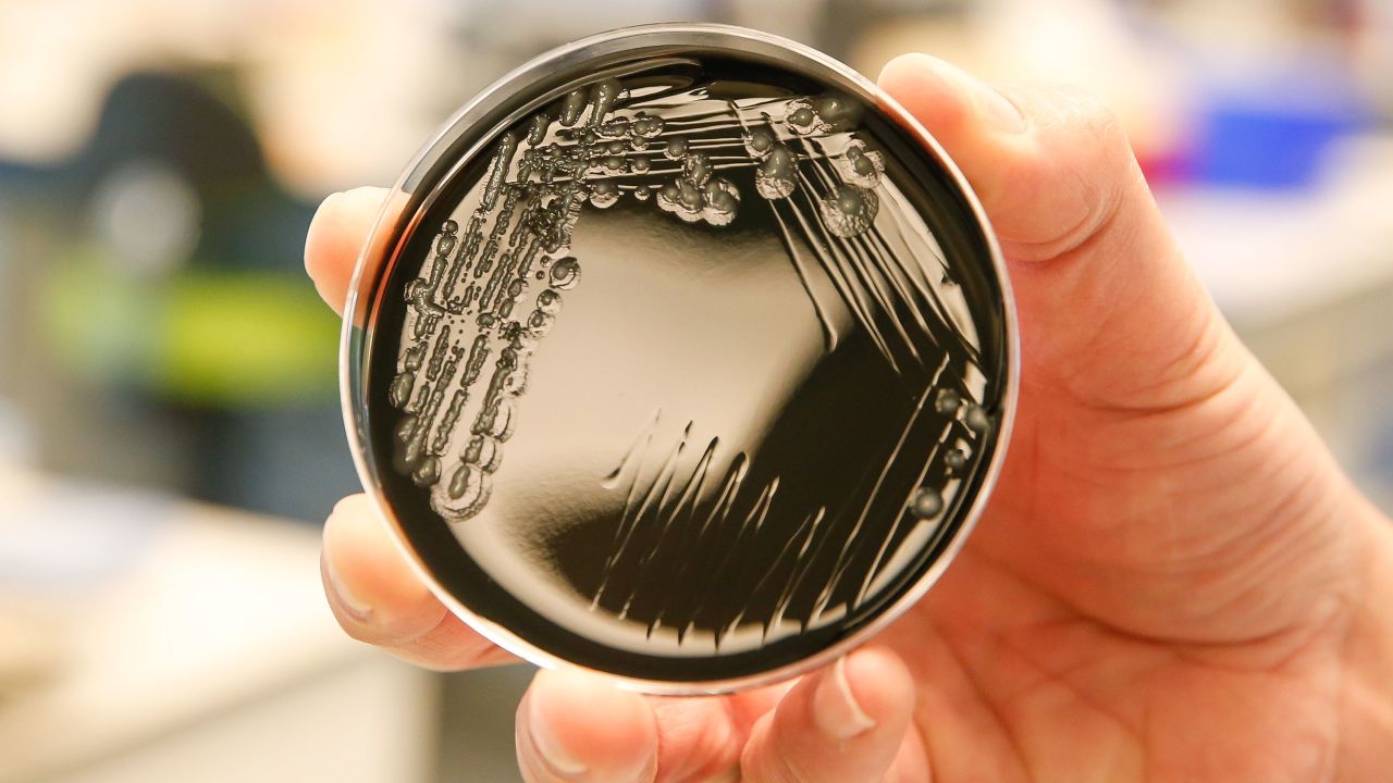 A culture of the Legionella pneumophila bacteria at a hospital in Belgium.
