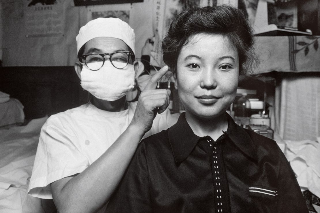 A doctor with a patient who has undergone plastic surgery to give her so-called "double eyelids."