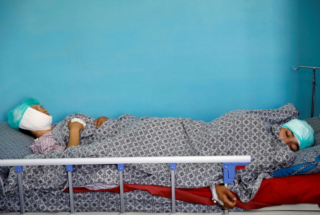 Injured women receive treatment at a hospital after a blast in Kabul, Afghanistan, on Tuesday, September 3.