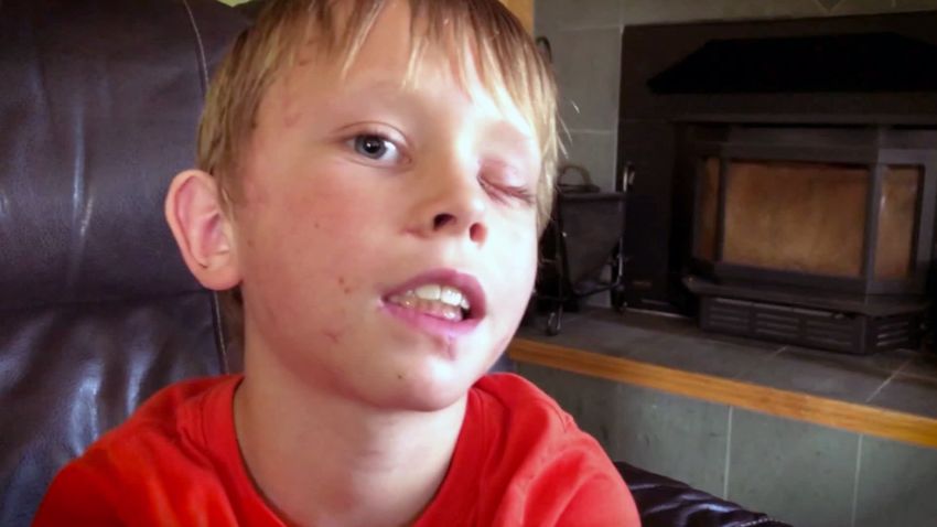 colorado mountain lion boy speaks out sot ndwknd vpx_00001319