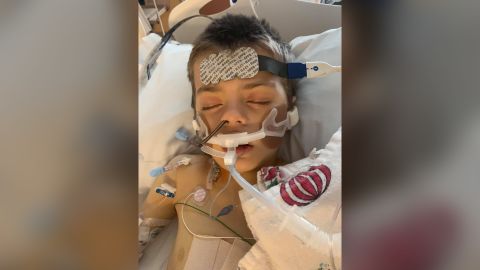 Doctors found a mysterious virus attacking Auten's liver.