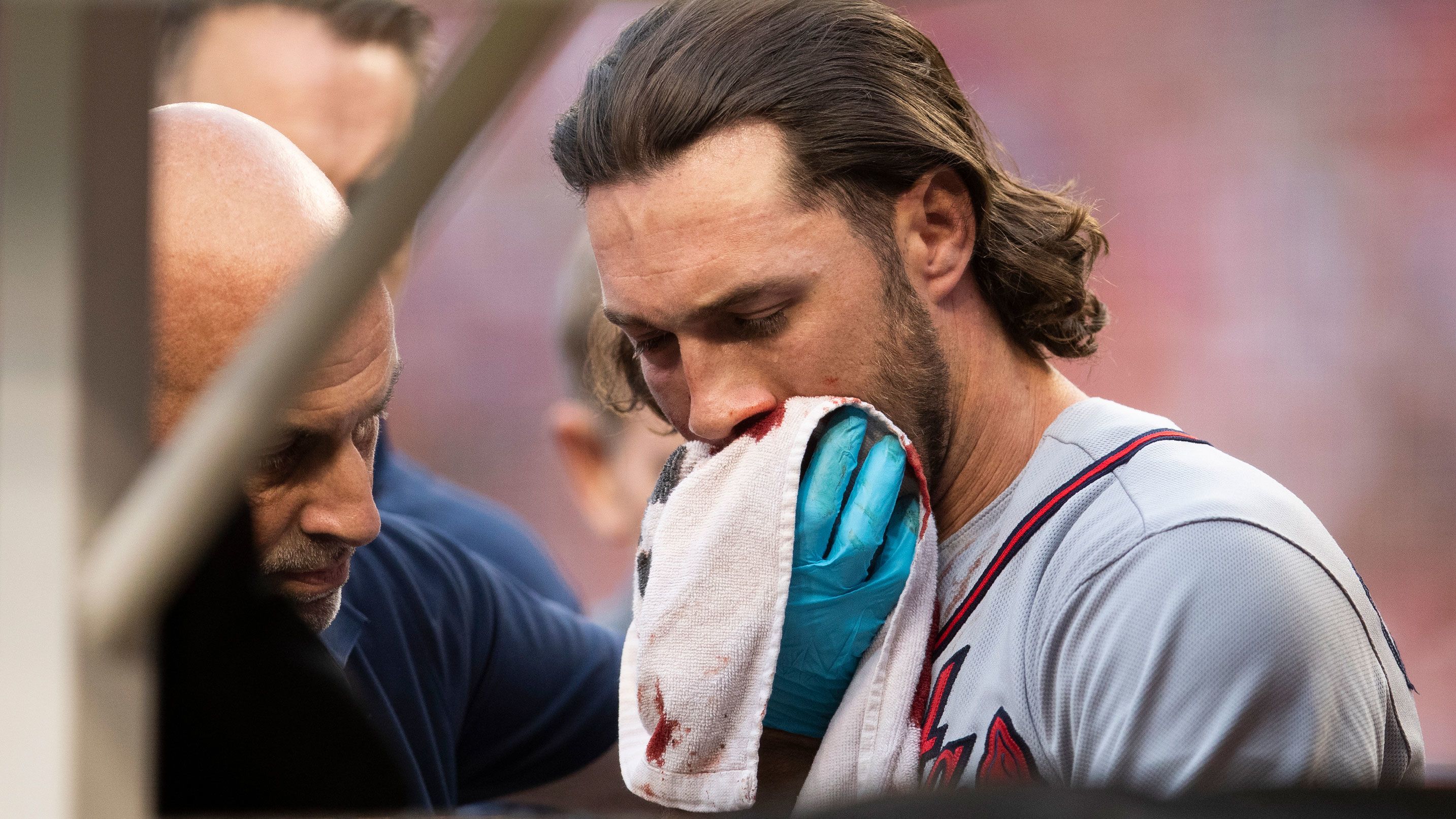 Braves outfielder Charlie Culberson was hit in the face with a 90 mph  fastball