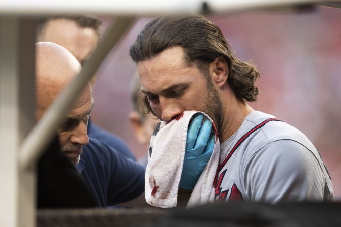 Atlanta's Charlie Culberson is removed from a game in Washington after <a href="index.php?page=&url=https%3A%2F%2Fwww.cnn.com%2F2019%2F09%2F15%2Fus%2Fbraves-culberson-pitch-face-baseball%2Findex.html" target="_blank">getting hit in the mouth by a 90 mph fastball</a> on Saturday, September 14.