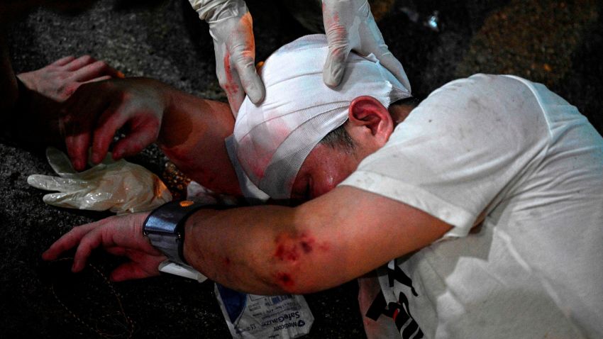EDITORS NOTE: Graphic content / A wounded man is helped by volunteer medics after a street brawl in Fortress Hill in Hong Kong on September 15, 2019. Eyewitnesses said the man was a pro-Beijing supporter who attacked pro-democracy supporters, but then got beaten up by a larger crowd. - Hong Kong riot police fired tear gas and water cannon at hardcore pro-democracy protesters hurling rocks and petrol bombs on September 15, tipping the violence-plagued city back into chaos after a brief lull in clashes. (Photo by Anthony WALLACE / AFP) / GRAPHIC CONTENT        (Photo credit should read ANTHONY WALLACE/AFP/Getty Images)