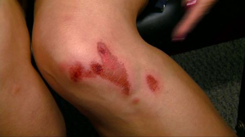The agent sustained minor injuries to her knee.