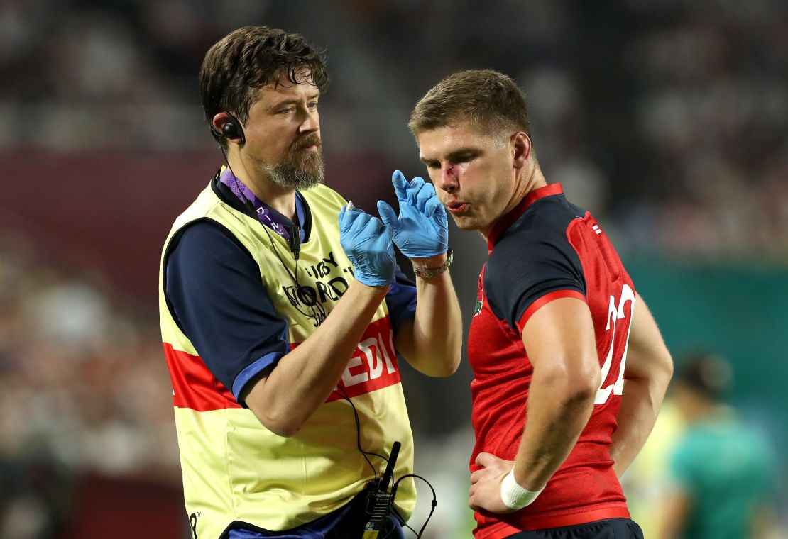 England's Owen Farrell receives medical treatment after a horror tackle. 