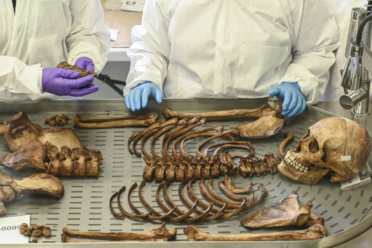 Forensics officials study a missing person's skeleton at a laboratory in Medellin, Colombia, on Tuesday, September 24.