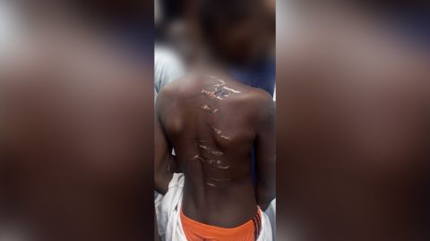 Scars on the body of a youth rescued from a school in Nigeria.