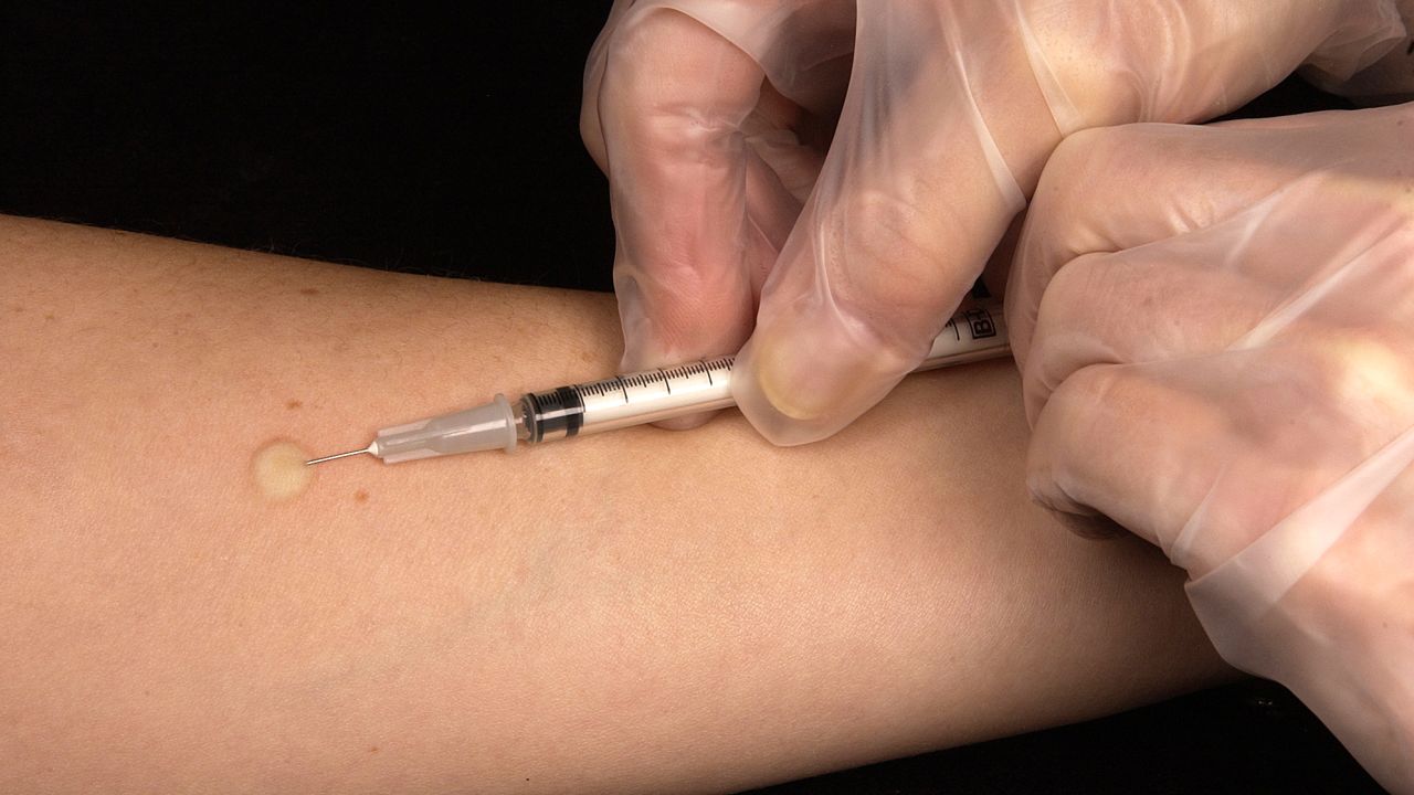 This photo shows a health care worker administering a tuberculin skin test.  
