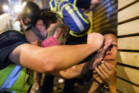 A woman is treated after police fired tear gas to disperse protesters in the Mong Kok district of Hong Kong on October 7.