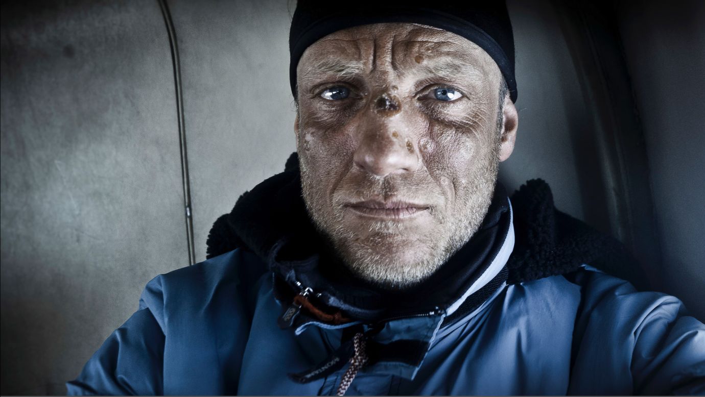 A self-portrait of Martin Hartley with frostbite on his nose. The British photographer has endured numerous dangerous experiences in the Arctic when weather conditions have deteriorated, or help has been unavailable.