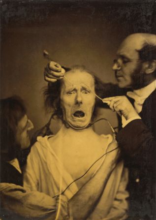 "Terror mixed with pain, torture" (1854-1856) by Guillaume-Benjamin-Amand Duchenne.