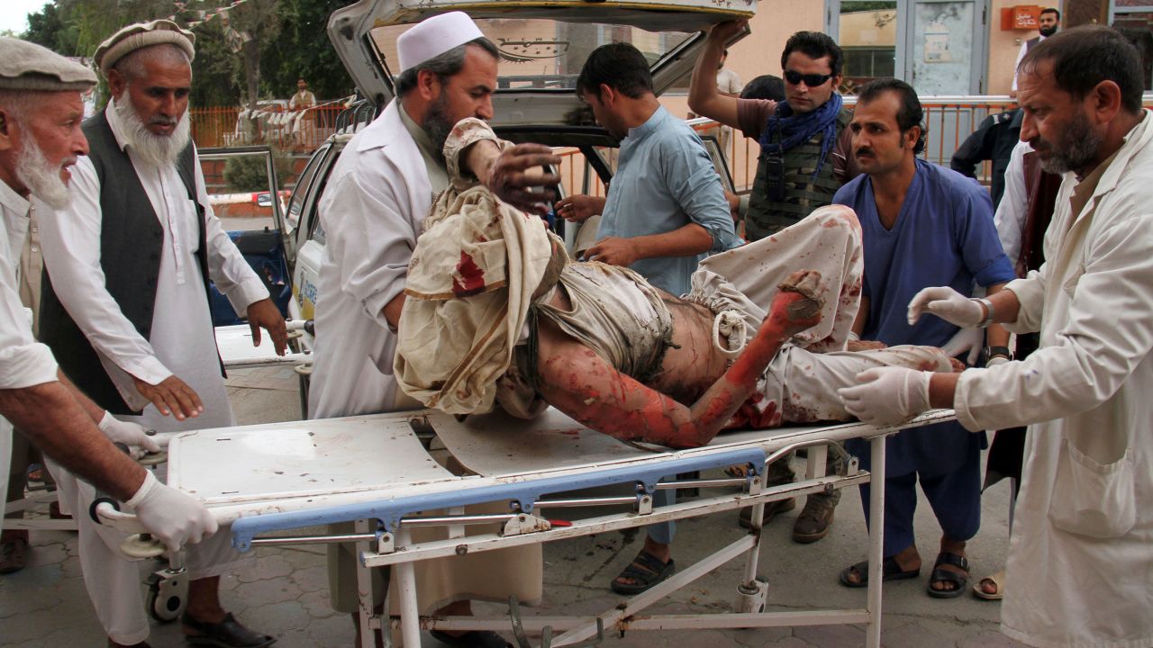 A man wounded in the attack is brought into a hospital in Jalalabad, east of Kabul, Afghanistan.