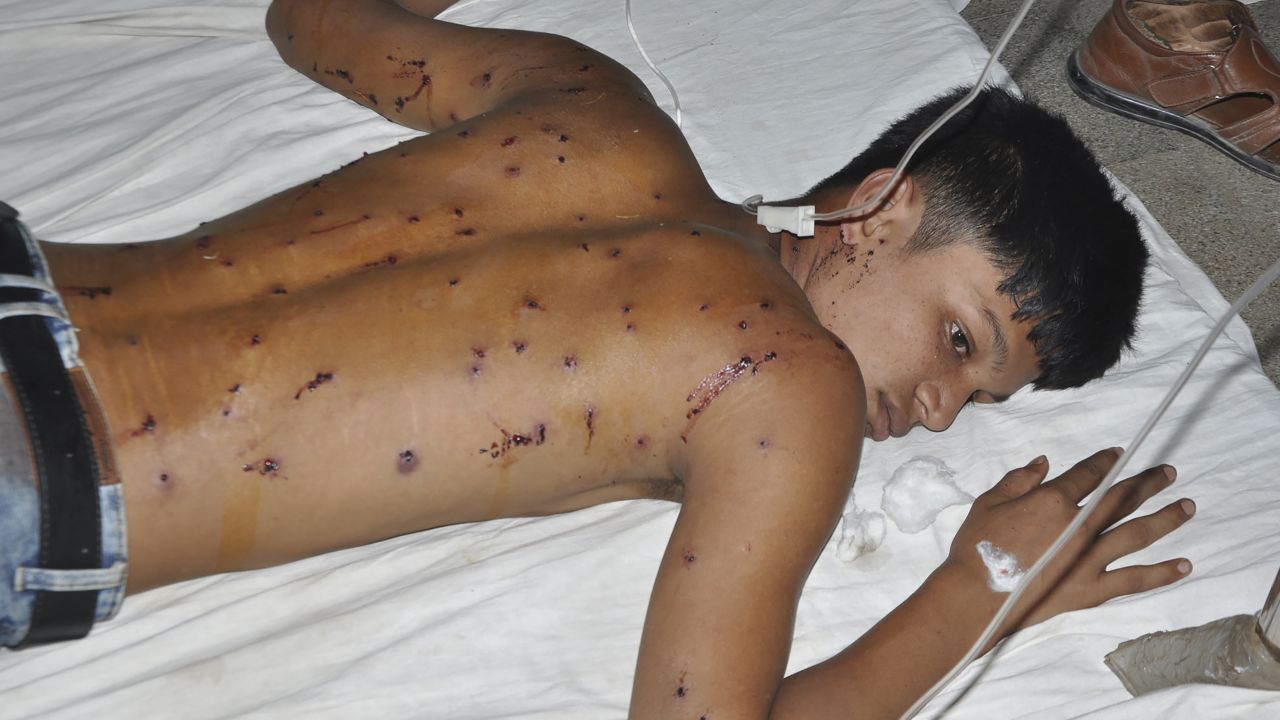 A demonstrator receives medical treatment in a hospital in Bangladesh.