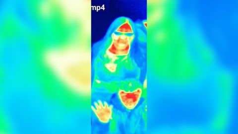 thermal imaging breast cancer scli intl scn