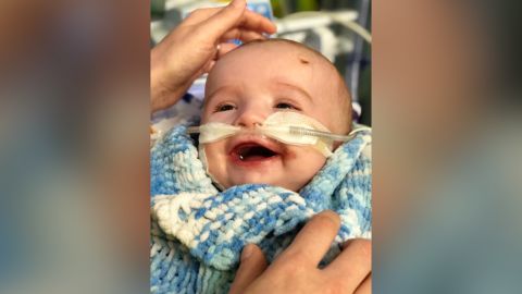 The family hopes to travel to the United States for surgery in April.