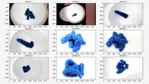 Images of synthetic stool, modeled from Play-Doh, that Auggi used to train a proof-of-concept algorithm to classify human waste.