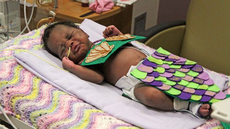 Here Are Some Ridiculously Cute Photos Of Babies In NICU Units Dressed ...