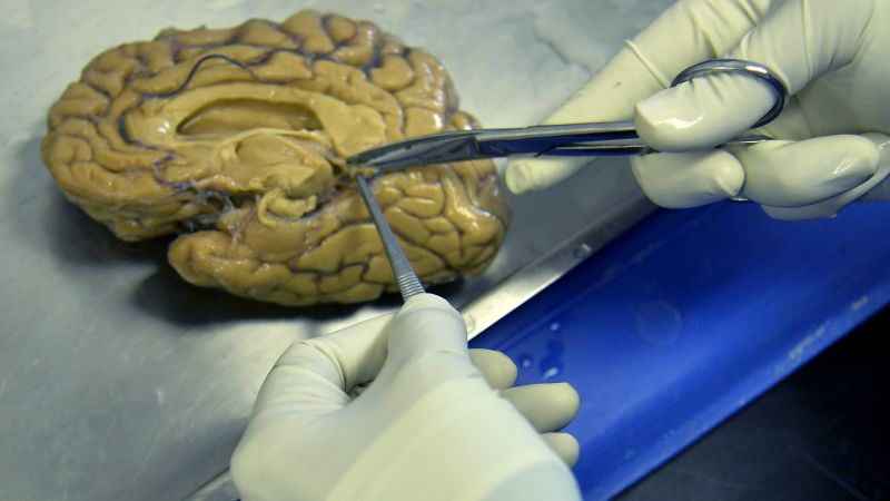 NextImg:Man who defied genetics for decades may hold a clue to preventing Alzheimer's, scientists say | CNN