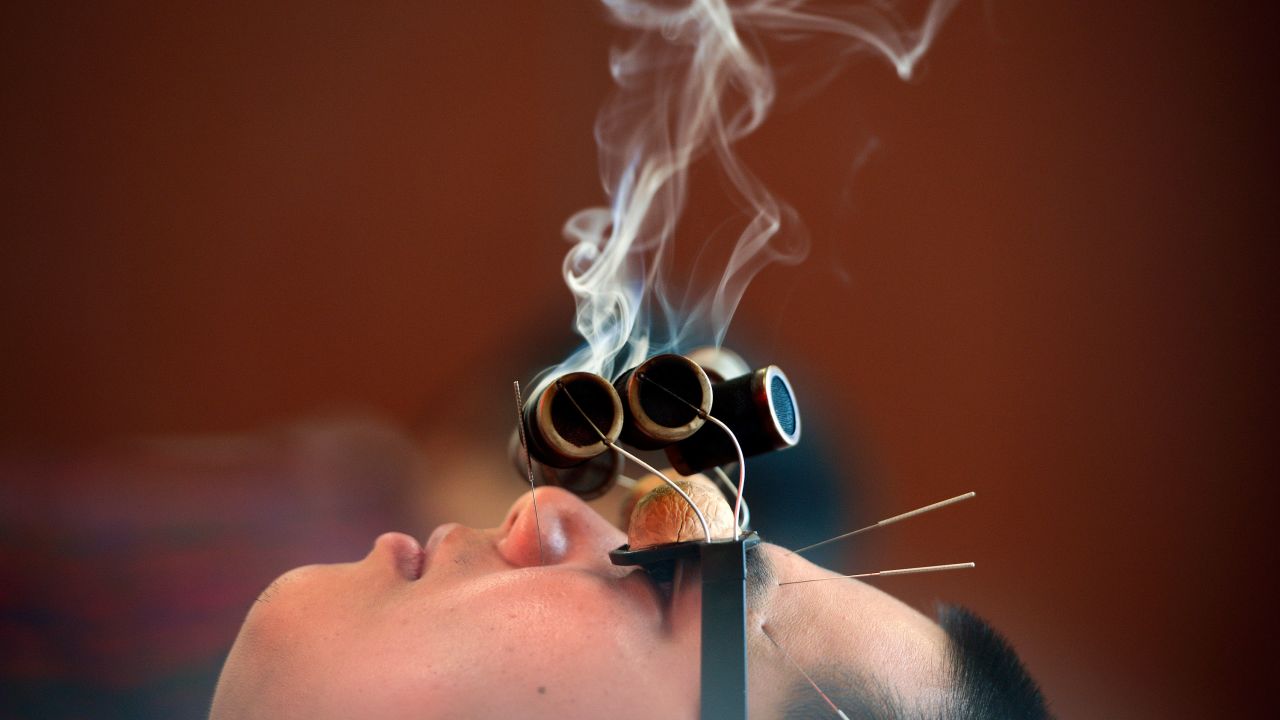 A man wearing "walnut" glasses is treated with smoking wormwood to relieve his oculomotor paralysis at a hospital on July 13, 2018 in Jiaxing, Zhejiang Province of China.