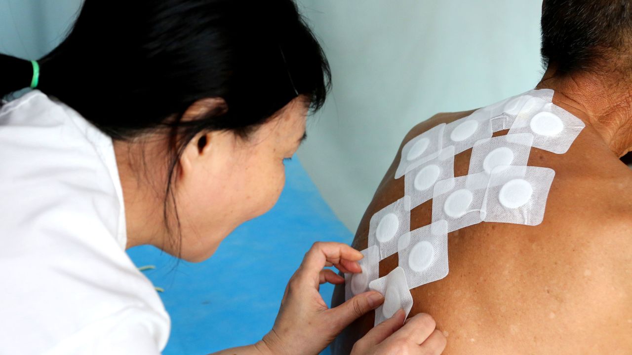 A patient receives treatment with bandages filled with herbs at a Traditional Chinese Medicine hospital on July 12, 2019 in Zaozhuang, Shandong Province, China.