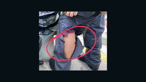 A handout image from the Hong Kong Police shows an arrow in the calf of an officer on Sunday.