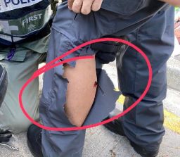 A handout image from the Hong Kong Police shows an arrow in the calf of an officer on Sunday.