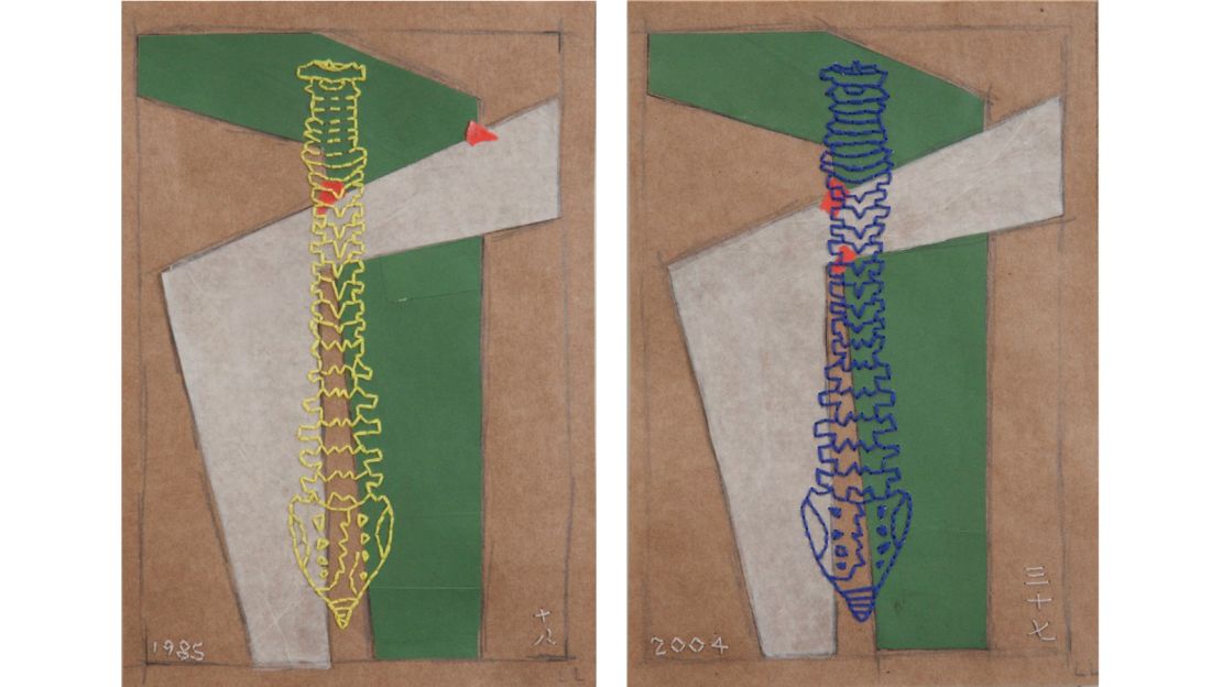 Liu's depictions of the human spine allude to her formative years.