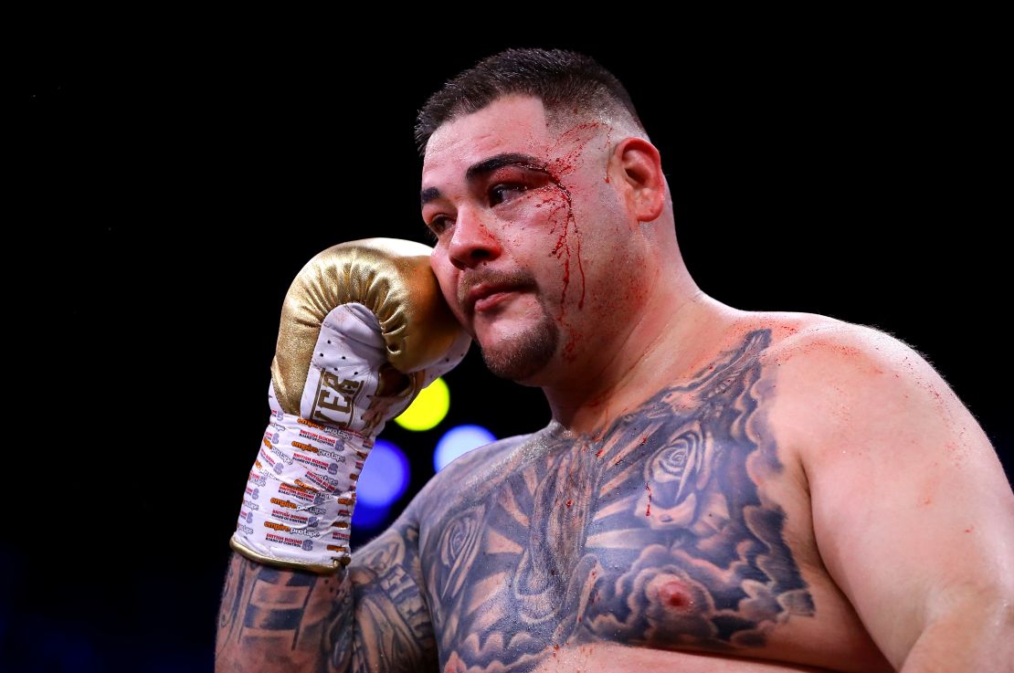  Andy Ruiz Jr was cut at the side of his left eye early in his unanimous points defeat to Anthony Joshua in Saudi Arabia.