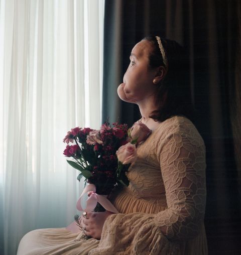 Katie Stubblefield poses for a portrait in November 2016. Stubblefield was at the Cleveland Clinic <a href="https://www.cnn.com/2018/08/14/health/face-transplant-suicide-attempt-natgeo-profile/index.html" target="_blank">to receive a face transplant.</a> She shot herself in 2014 when she was 18. Now, she hopes to use her historic surgery to raise awareness about the lasting harms of suicide and the precious value of life.